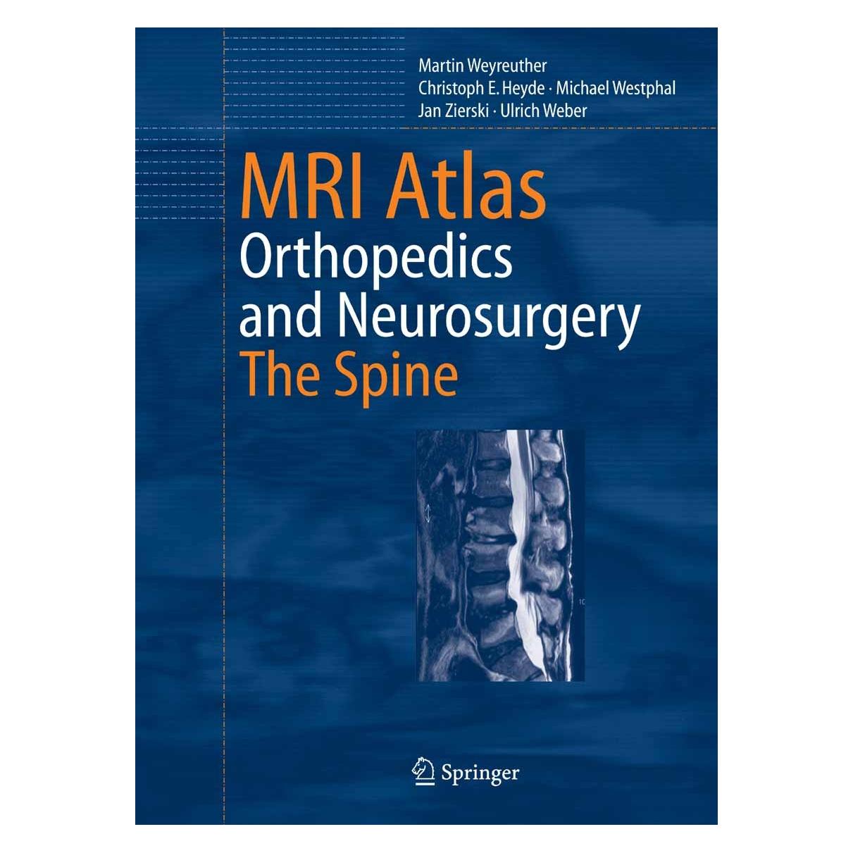 Springer MRI Atlas (Englisch, Hardcover, Christoph E. Heyde, Jan Zierski, Martin Weyreuther, Michael Westphal, Ulrich Weber) (9783540335337)
