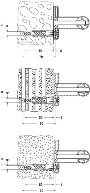 Keuco Befestigungs-Set Nr.1 Plan Care 34990000100 3 Holzschrauben und 3 Universalduebel