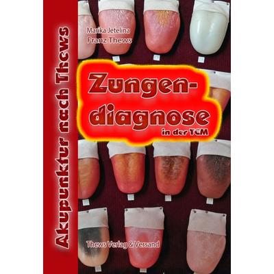 Zungendiagnose in 54 Bildern, Gebundene Ausgabe von Franz Thews, Thews, F, 978-3-936456-14-1