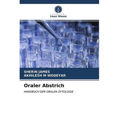Oraler Abstrich, Taschenbuch von Sherin James,Akhilesh M. Wodeyar, Verlag Unser Wissen, 978-620-3-21758-2