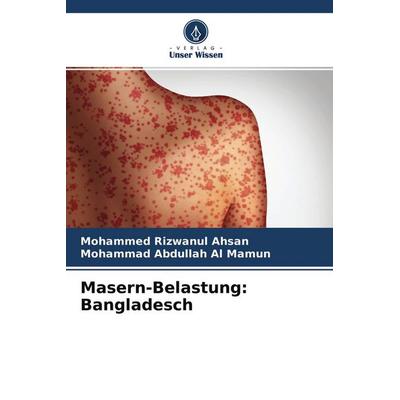 Masern-Belastung: Bangladesch, Taschenbuch von Mohammed Rizwanul Ahsan,Mohammad Abdullah Al Mamun, Verlag Unser Wissen, 978-620-4-45251-7