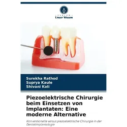 Piezoelektrische Chirurgie beim Einsetzen von Implantaten: Eine moderne Alternat, Fachbücher von Surekha Rathod, Suprya Kaule, SHIVANI KOLI