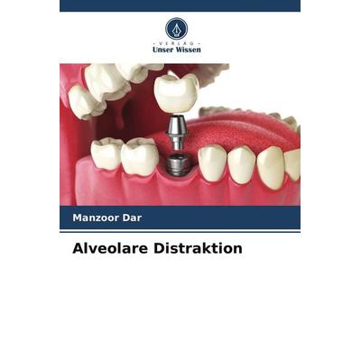 Alveolare Distraktion, Taschenbuch von Manzoor Dar, Verlag Unser Wissen, 978-620-5-65109-4
