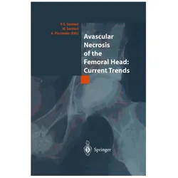 Avascular Necrosis of the Femoral Head: Current Trends, Fachbücher von Francesco Saverio Santori, Annarita Piccinato, Nicola Santori
