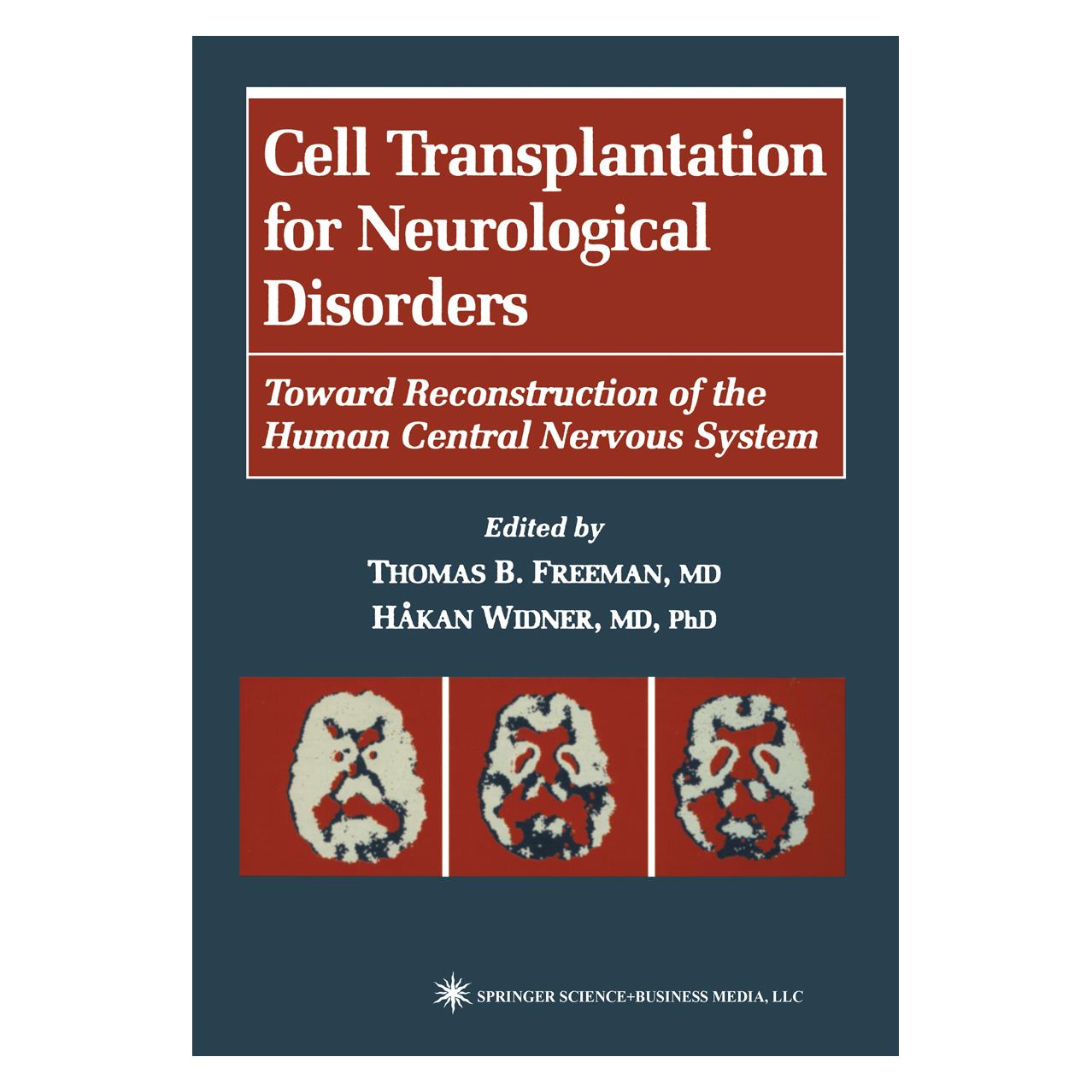 Springer Cell Transplantation for Neurological Disorders (Englisch, Softcover, Hakan Widner, Thomas B. Freeman) (55382209)