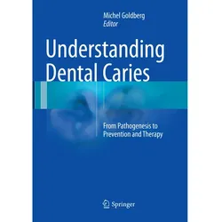 Understanding Dental Caries, Fachbücher