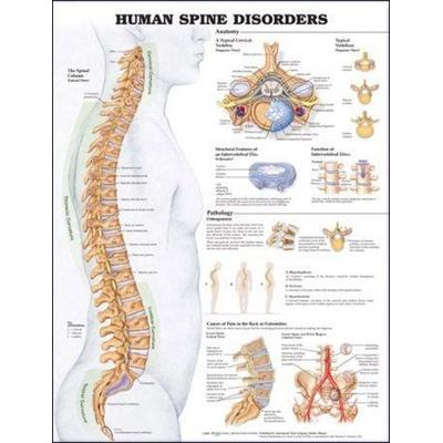 Human Spine Disorders Anatomical Chart, von Tbd, Wolters Kluwer Health, 978-1-58779-399-8
