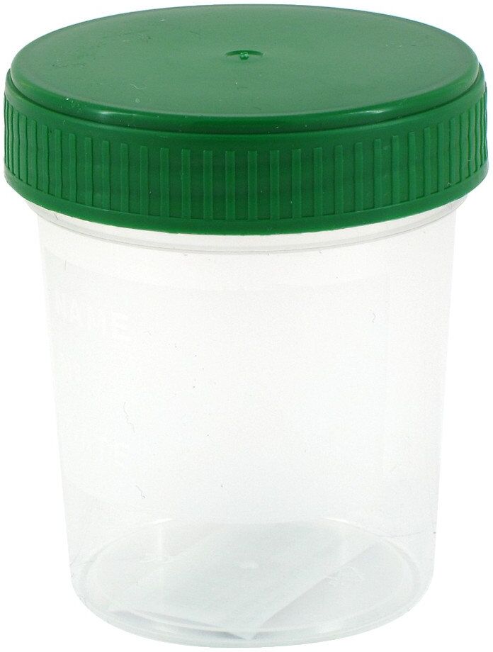 Urinbecher 120 ml gradu.beschr.m.Schraubdeckel