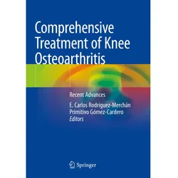 Comprehensive Treatment of Knee Osteoarthritis, Fachbücher