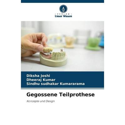 Gegossene Teilprothese, Taschenbuch von Diksha Joshi,Dheeraj Kumar,Sindhu Sudhakar Kumararama, Verlag Unser Wissen, 978-620-9-08850-6