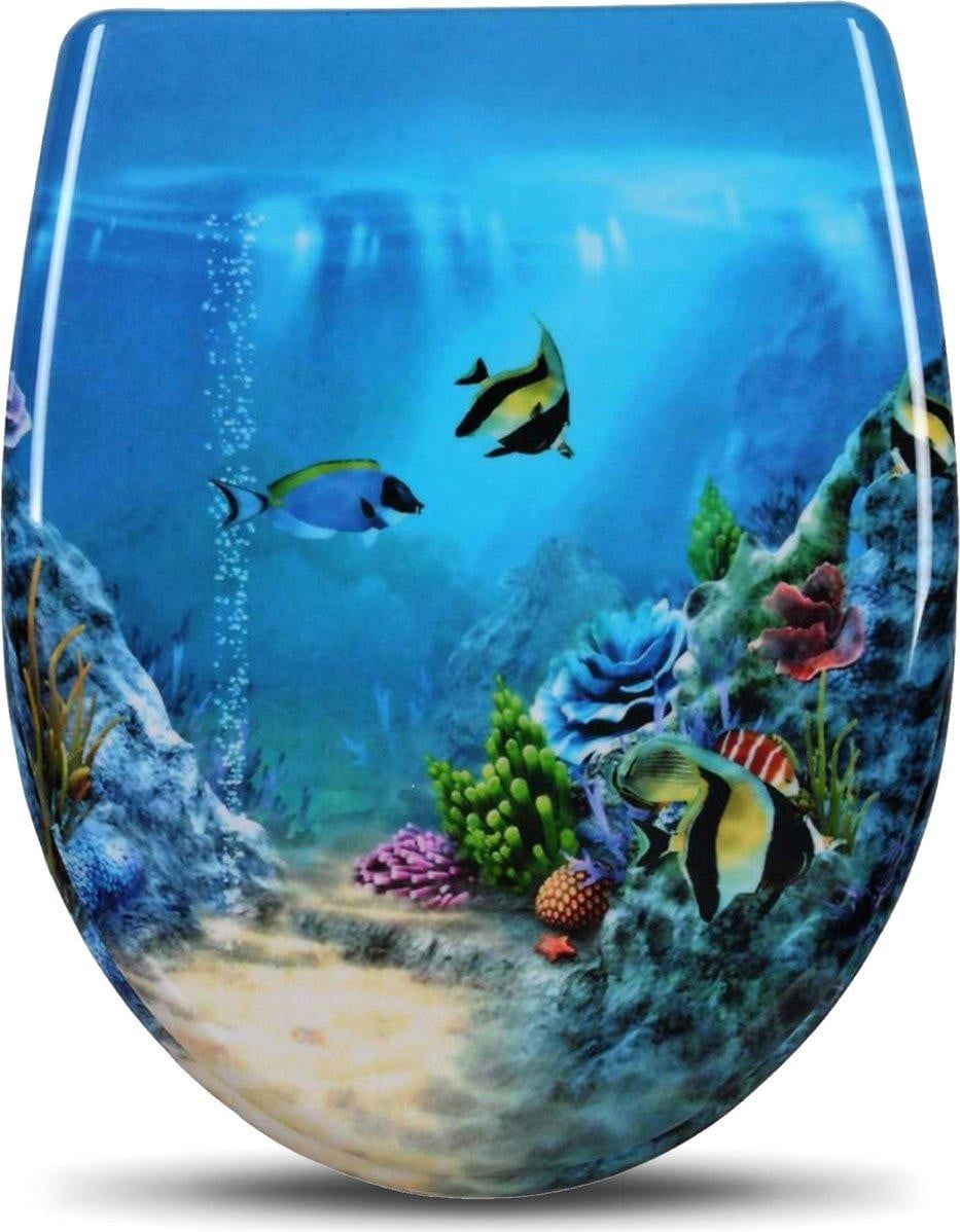 Happyment toiletzitting met Fischdesign, Softclose en Antibacterieel, Universeel