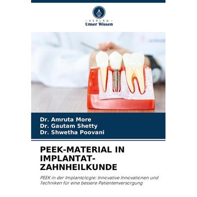 Peek-Material in Implantat-Zahnheilkunde, Taschenbuch von Amruta More,Gautam Shetty,Shwetha Poovani, Verlag Unser Wissen, 978-620-8-32929-7