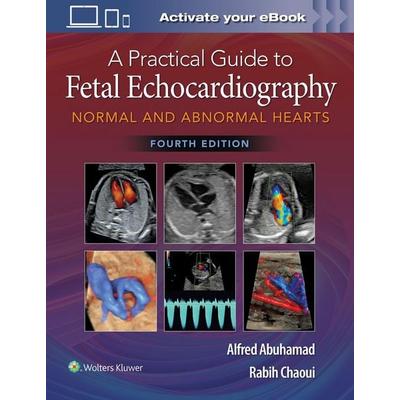 A Practical Guide to Fetal Echocardiography, Gebundene Ausgabe von Alfred Z. Abuhamad,Rabih Chaoui, Lippincott Williams&Wilki, 978-1-975126-81-0