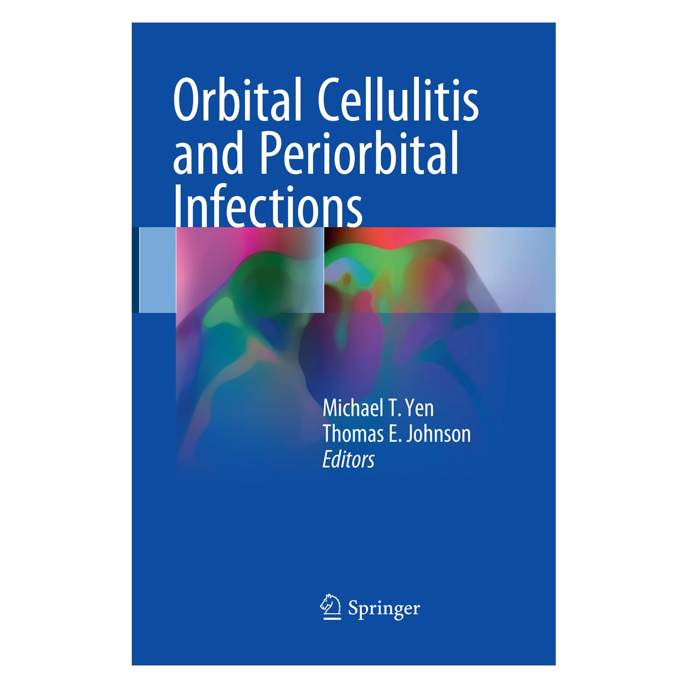 Springer Orbital Cellulitis and Periorbital Infections (Englisch, Softcover, Michael Yen, Thomas E. Johnson) (56052176)