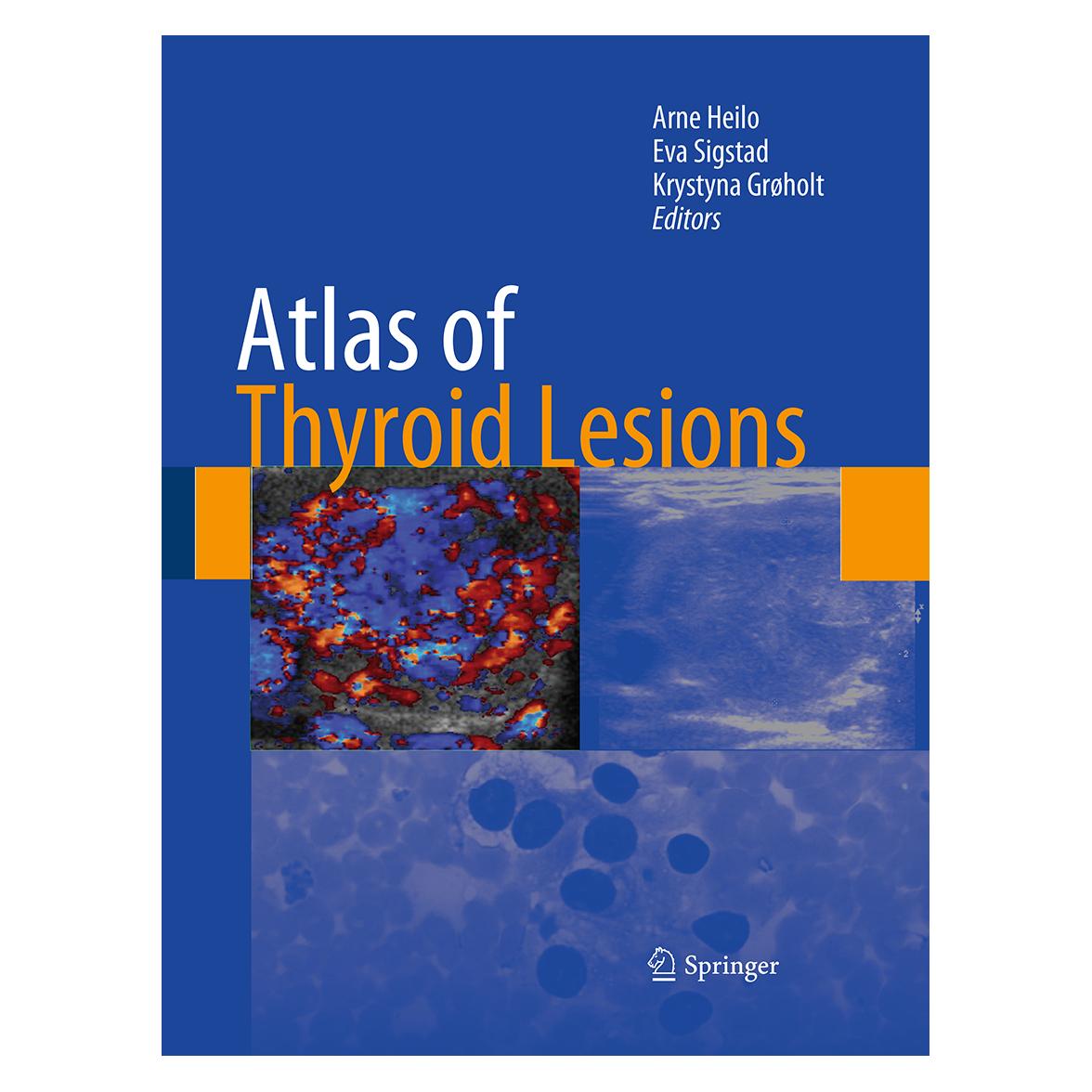 Springer Atlas of Thyroid Lesions (Englisch, Softcover, Arne Heilo, Eva Sigstad, Krystyna Grøholt) (55951732)