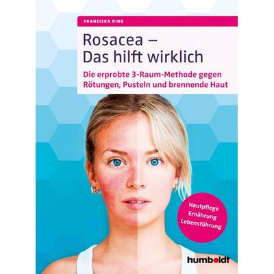 Rosacea – Das hilft wirklich, Taschenbuch von Franziska Ring, Humboldt Verlag, 978-3-86910-052-4