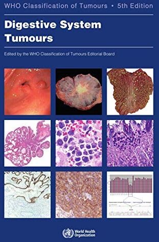 Who Classification of Tumours Editorial - Digestive System Tumours: Who Classification of Tumours (World Health Organization Classification of Tumours, Band 1) - Preis vom 09.10.2026 07:28:09 h