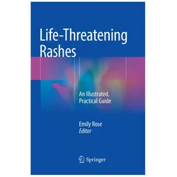 Life-Threatening Rashes, Fachbücher von Emily Rose