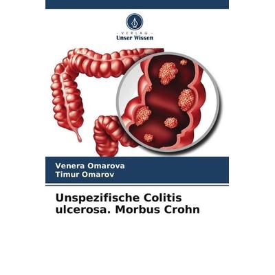 Unspezifische Colitis ulcerosa. Morbus Crohn, Taschenbuch von Venera Omarova,Timur Omarov, Verlag Unser Wissen, 978-620-5-43116-0