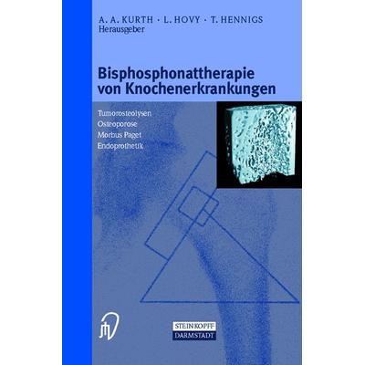 Bisphosphonattherapie von Knochenerkrankungen, Taschenbuch von A. A. Kurth,Louis Hovy,T. Hennings, Steinkopff, 978-3-7985-1266-5