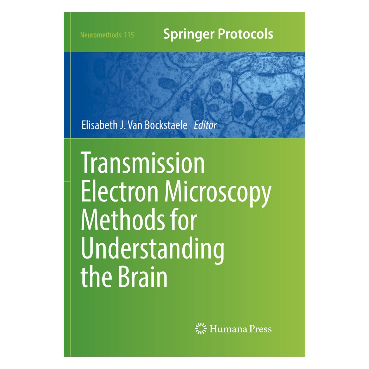 Springer Transmission Electron Microscopy Methods for Understanding the Brain (Englisch, Softcover, Elisabeth J Van Bockstaele, J Van Bockstaele Elisabeth) (55998401)