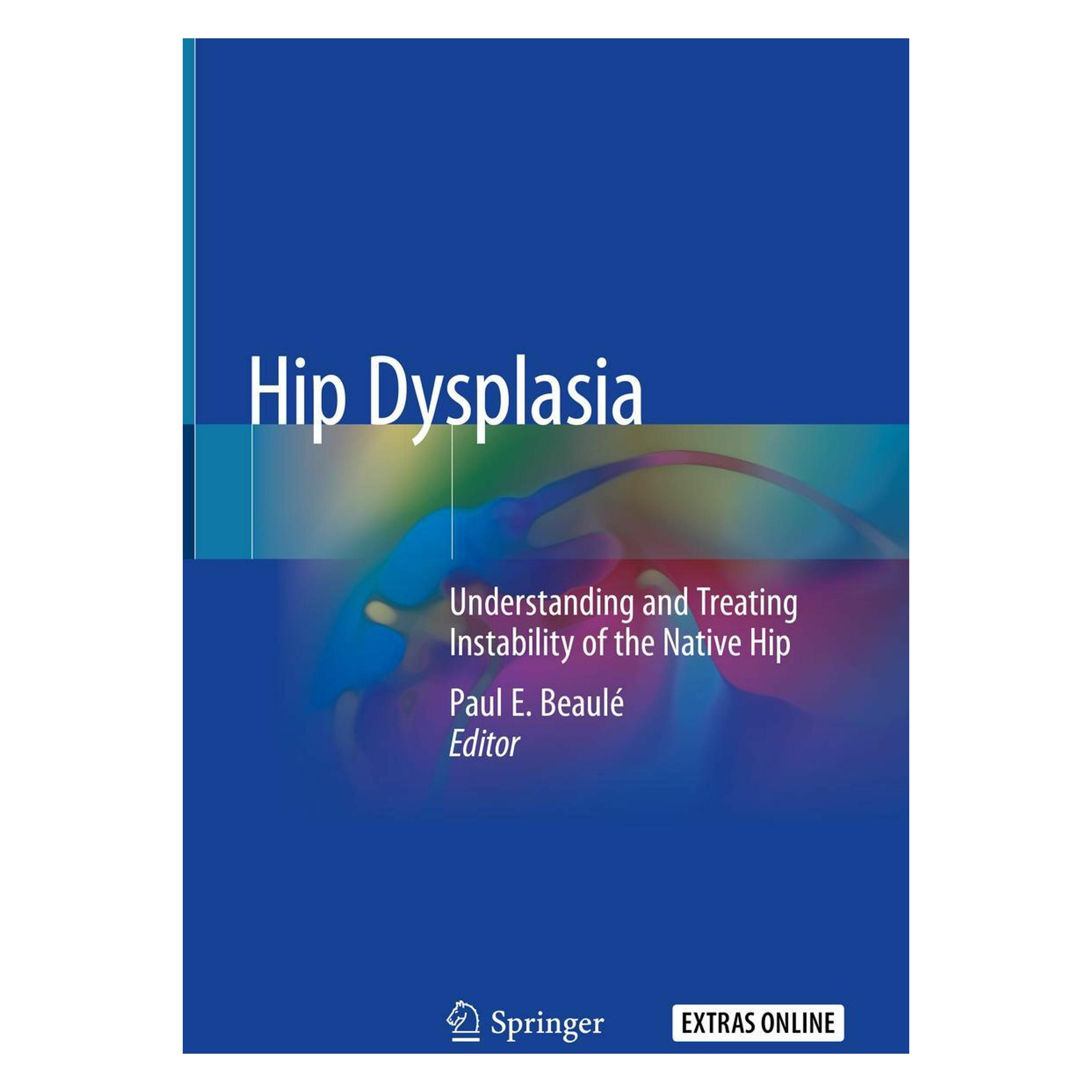 Springer Hip Dysplasia (Englisch, Hardcover, Paul E. Beaulé) (9783030333577)
