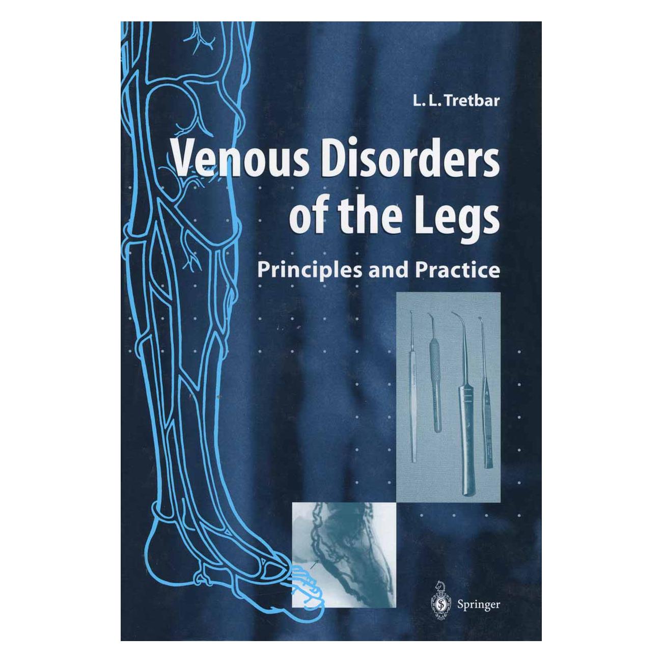Springer Venous Disorders of the Legs (Englisch, Softcover, Lawrence L Tretbar) (55492774)