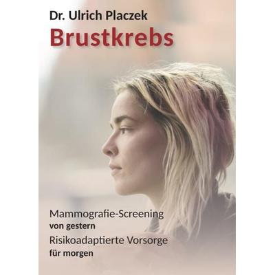 Brustkrebs, Paperback von Ulrich Placzek, Romeon-Verlag, 978-3-96229-171-6