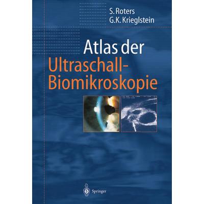 Atlas der Ultraschall-Biomikroskopie, Taschenbuch von Sigrid Roters,Günter K. Krieglstein, Springer Berlin, 978-3-642-63144-3