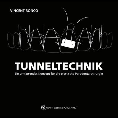 Tunneltechnik, Gebundene Ausgabe von Vincent Ronco, Quintessenz Verlag, 978-3-86867-718-8