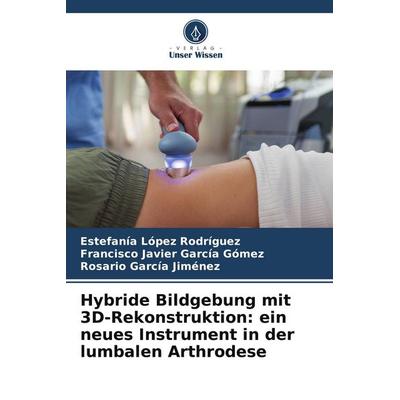 Hybride Bildgebung mit 3D-Rekonstruktion: ein neues Instrument in der lumbalen Arthrodese, Taschenbuch von Estefanía López Rodríguez,Francisco Javier