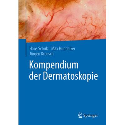 Kompendium der Dermatoskopie, Gebundene Ausgabe von Hans Schulz,Max Hundeiker,Jürgen Kreusch, Springer Berlin, 978-3-662-49490-5