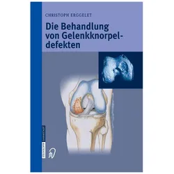 Die Behandlung von Gelenkknorpeldefekten, Fachbücher von Christoph Erggelet