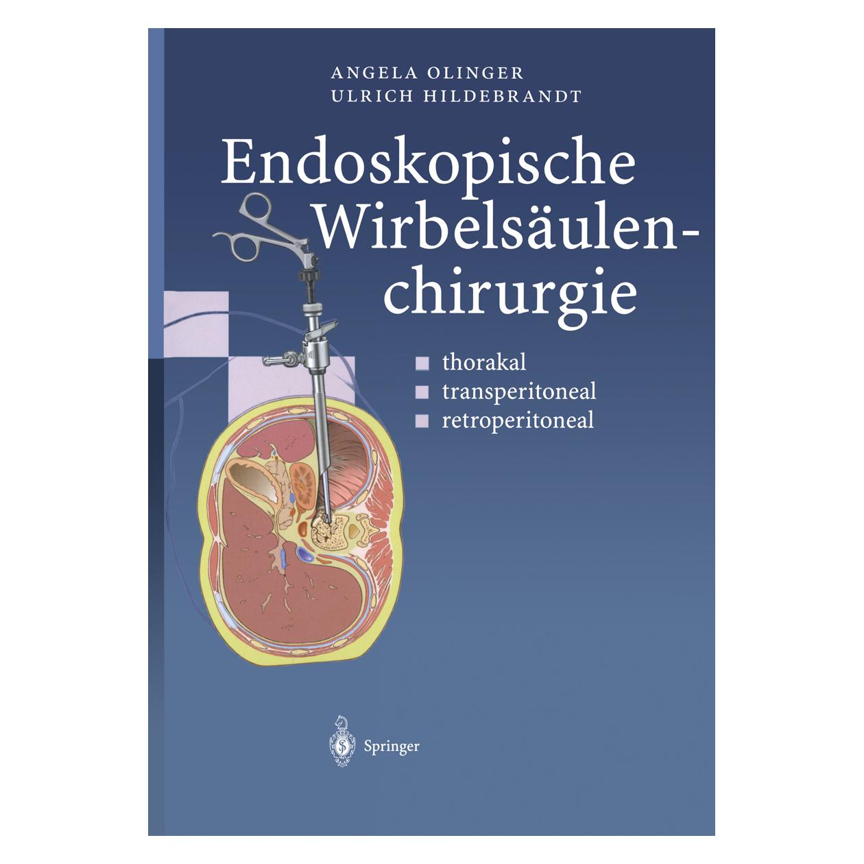 Springer Endoskopische Wirbelsäulenchirurgie (Deutsch, Softcover, Angela Olinger, Ulrich Hildebrandt) (7459088)