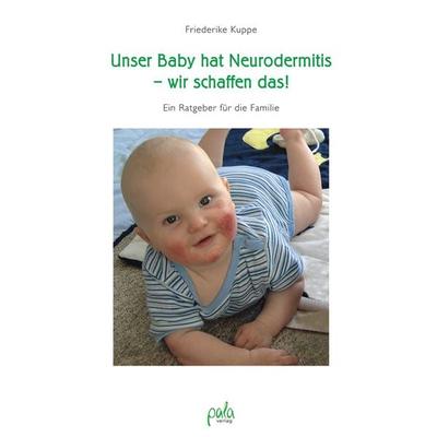 Unser Baby hat Neurodermitis - wir schaffen das!, Gebundene Ausgabe von Friederike Kuppe, Pala, 978-3-89566-230-0