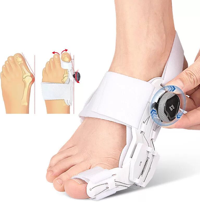 INF Correcteur de couteau pour un alignement efficace des orteils