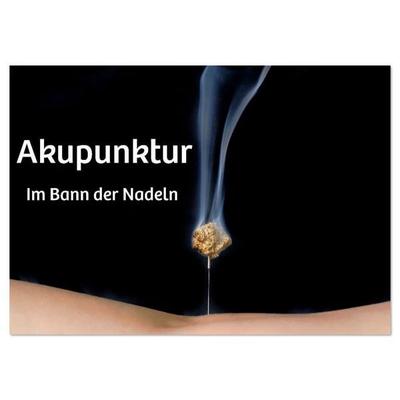 Akupunktur - Im Bann der Nadeln (Wandkalender 2026 DIN A3 quer), CALVENDO Monatskalender