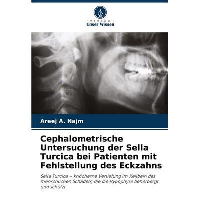 Cephalometrische Untersuchung der Sella Turcica bei Patienten mit Fehlstellung des Eckzahns, Taschenbuch von Areej A. Najm, Verlag Unser Wissen,