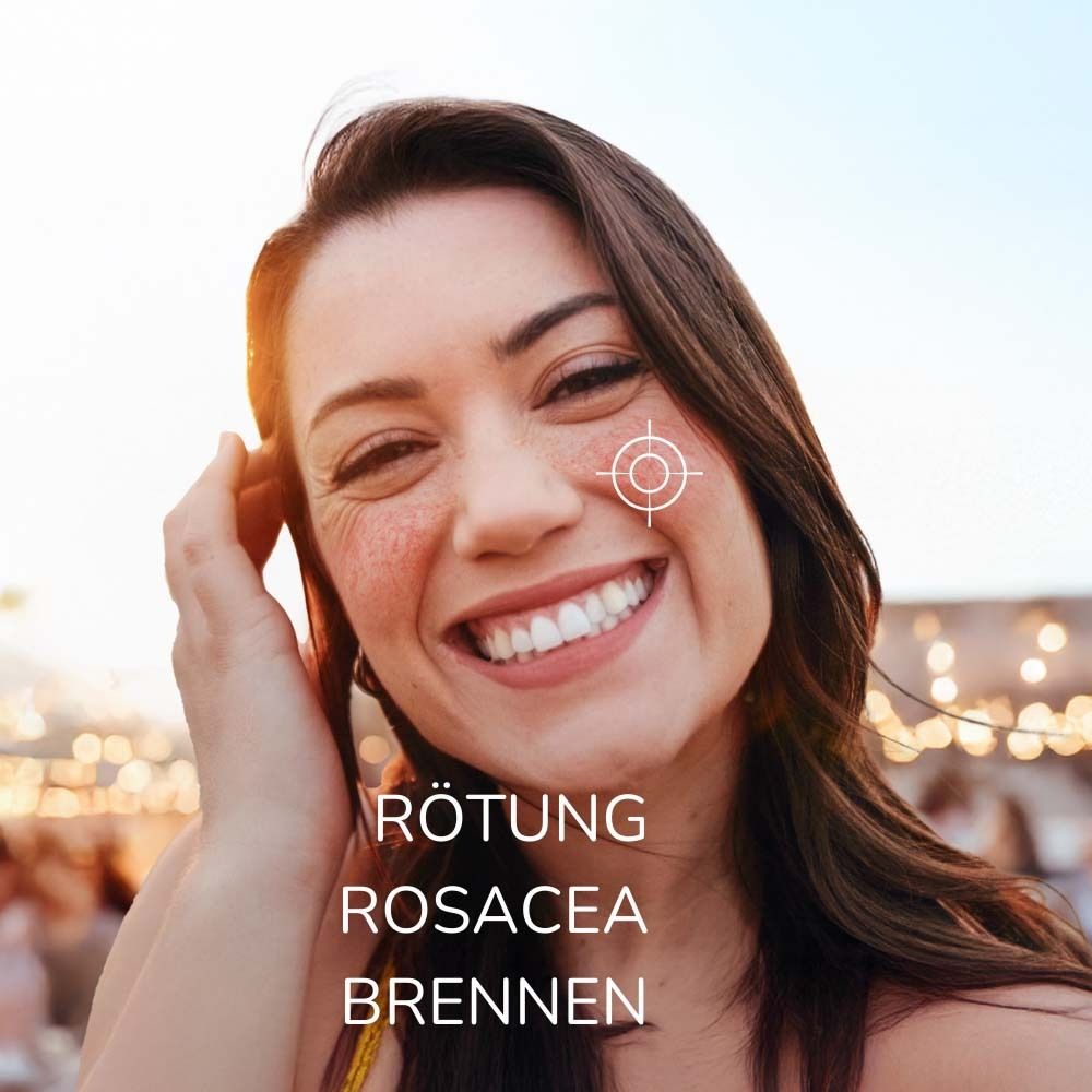 Allergika Anti-Rötung Rosacea Creme MED 30 ml