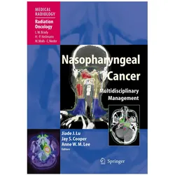 Nasopharyngeal Cancer, Fachbücher von Jiade J. Lu, Jay S. Cooper, Anne W. M. Lee, Jay, Anne, S Cooper, W M Lee