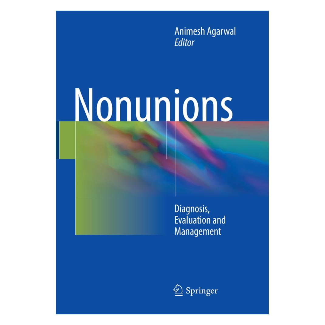 Springer Nonunions (Englisch, Softcover, Animesh Agarwal) (56053634)