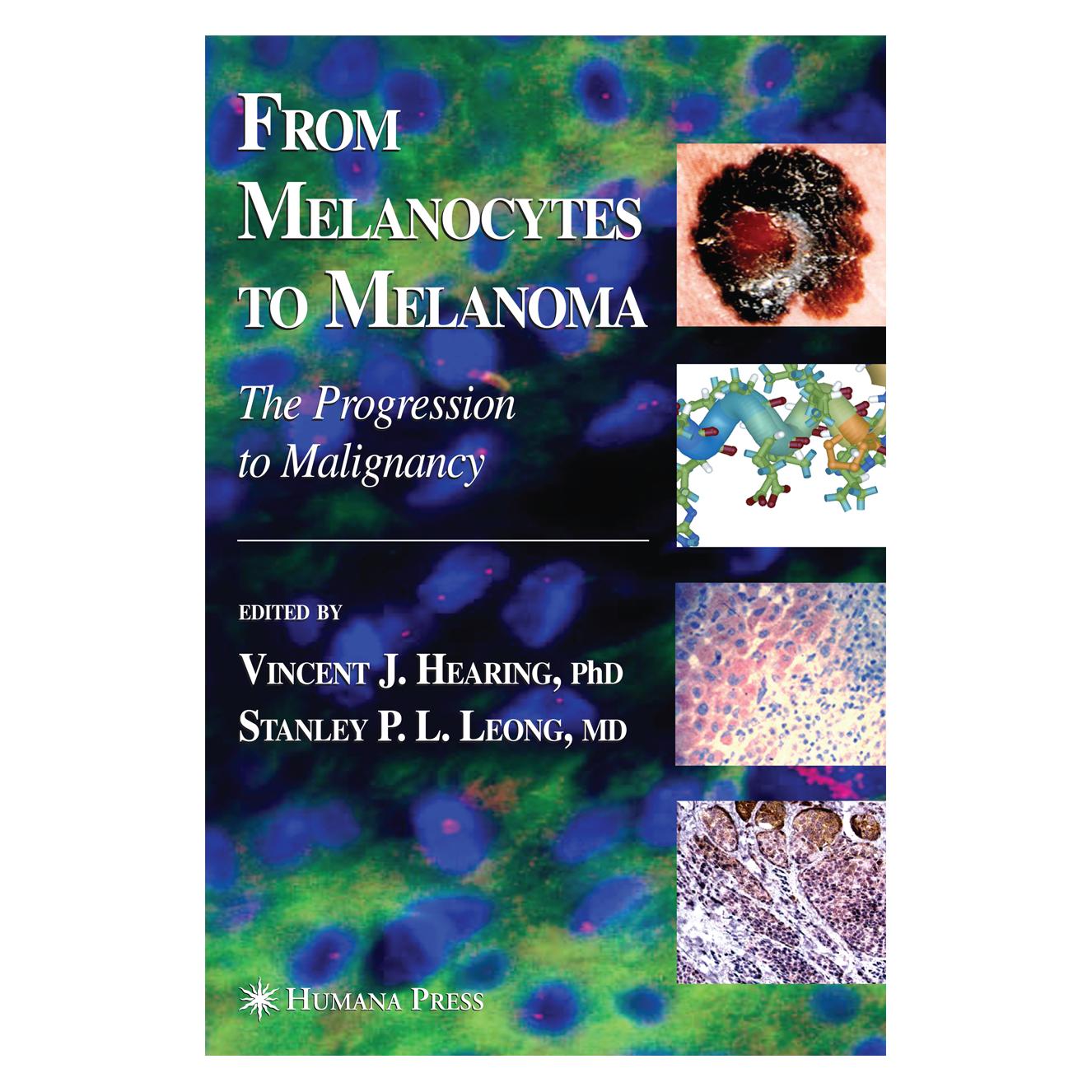 Humana Press From Melanocytes to Melanoma (Englisch, Softcover, Stanley P. L. Leong, Vincent J. Hearing) (35092878)
