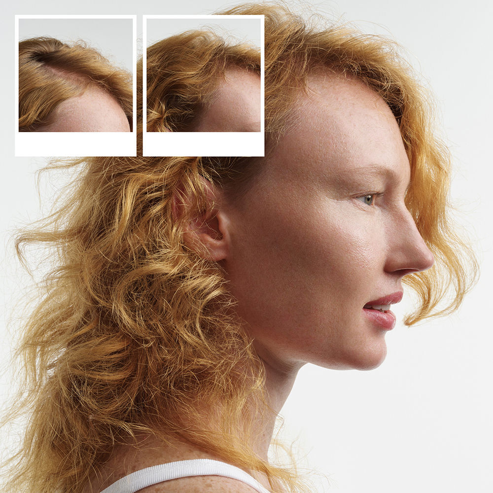 Nioxin Sistema 4 - Kit - Tratamiento para Cabello Teñido con Debilitamiento Avanzado 3 u
