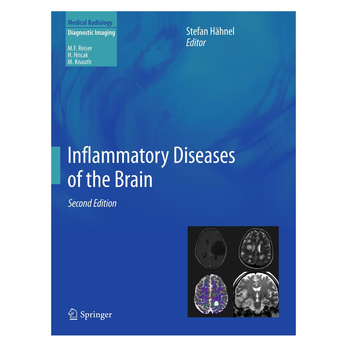 Springer Inflammatory Diseases of the Brain (Englisch, Softcover, Stefan Hähnel) (55593090)