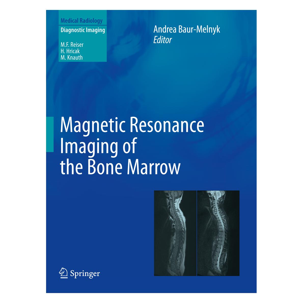 Springer Magnetic Resonance Imaging of the Bone (Englisch, Hardcover, Andrea Baur-Melnyk) (9783642178597)