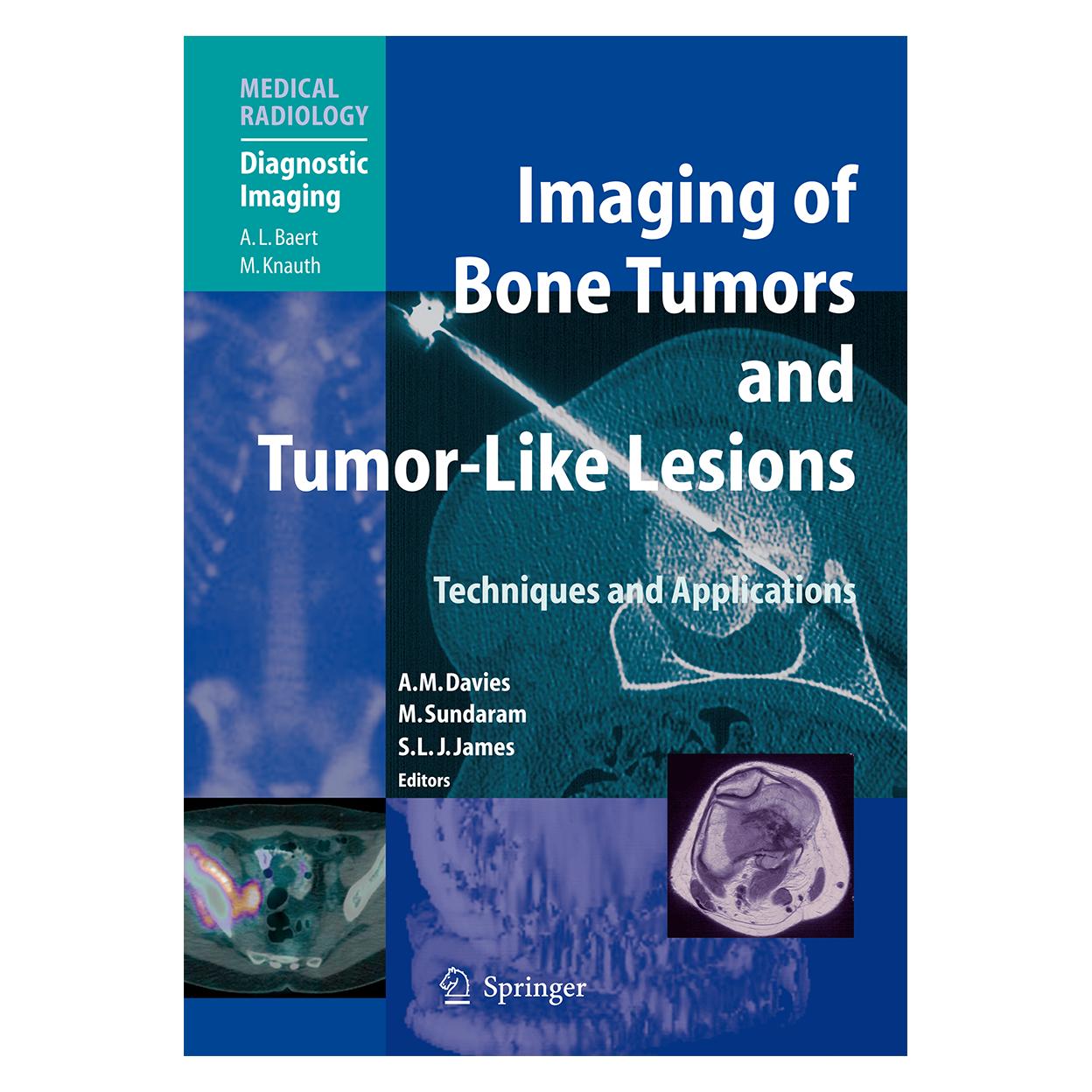 Springer Imaging of Bone Tumors and Tumor-Like Lesions (Englisch, Softcover, A. Mark Davies, Murali Sundaram, Steven J. James) (55948872)