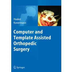Computer and Template Assisted Orthopedic Surgery, Fachbücher