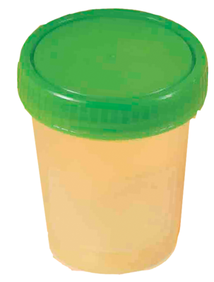 Careliv Produkte OHG URINBECHER mit Schraubdeckel 1 St 02771173