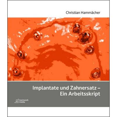 Implantate und Zahnersatz - Ein Arbeitsskript, Taschenbuch von Christian Hammächer, Mgo fachverlage, 978-3-00-069028-0