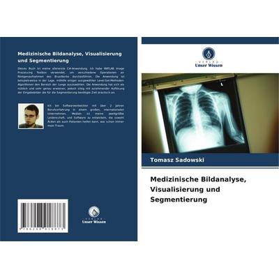 Medizinische Bildanalyse, Visualisierung und Segmentierung, Taschenbuch von Tomasz Sadowski, Verlag Unser Wissen, 978-620-8-91887-3